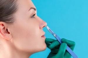 burun-estetigi-oncesi