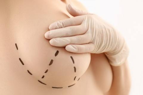 gogus-estetigi-nedir-nasil-yapilir